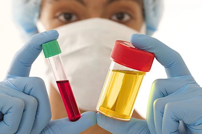 Анализ мочи и крови