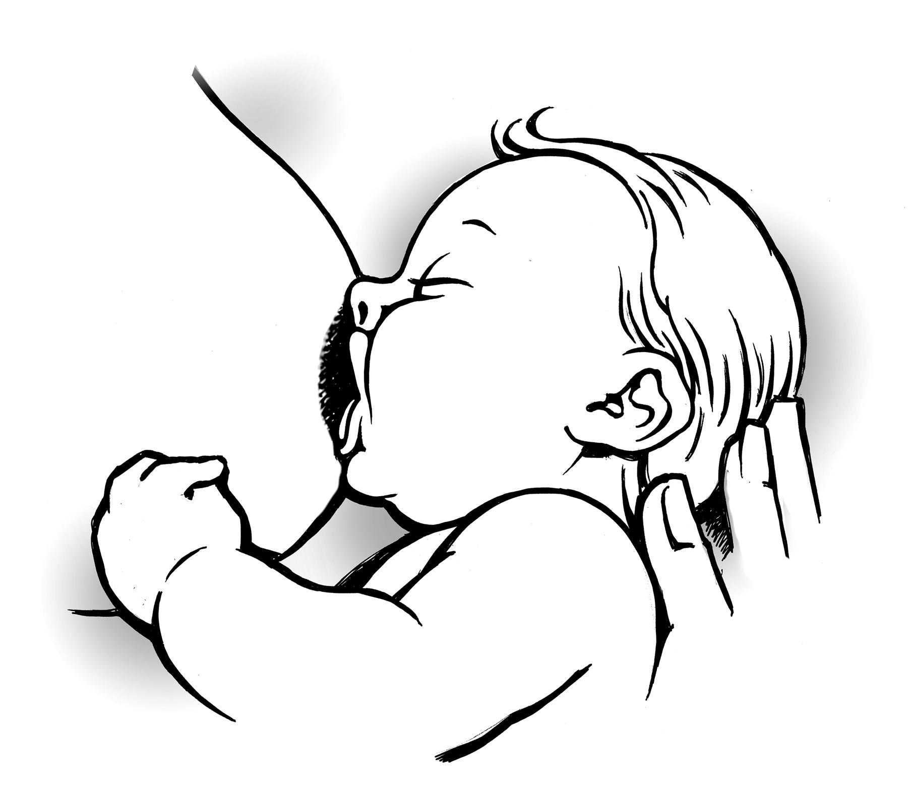 Неполный захват соска Неполный захват соска