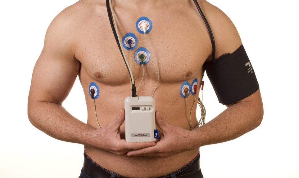 Мониторинг по Холтеру