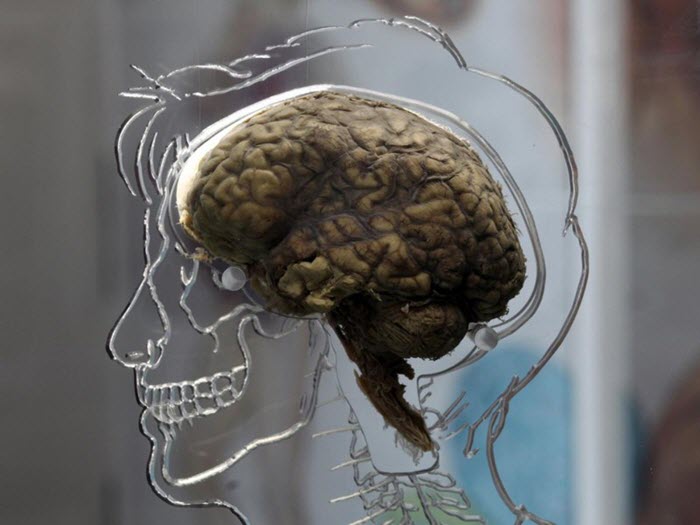 Психопатологическое состояние