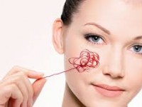 как избавиться от сосудистых звездочек