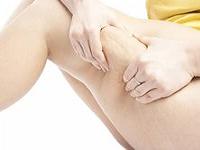 как избавиться от целлюлита на ногах