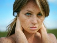 как избавиться от веснушек на лице