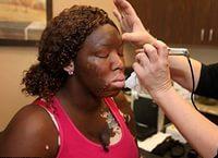 как избавиться от витилиго