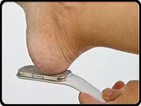 как лечить натоптыши на пятках