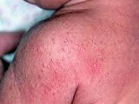 как выглядит потница