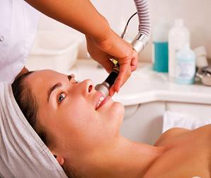 розацеа на лице лечение фото