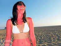 лечение солнечного ожога