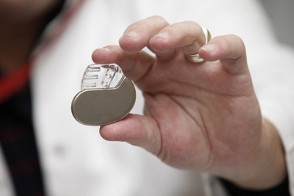 Установка кардиостимулятора