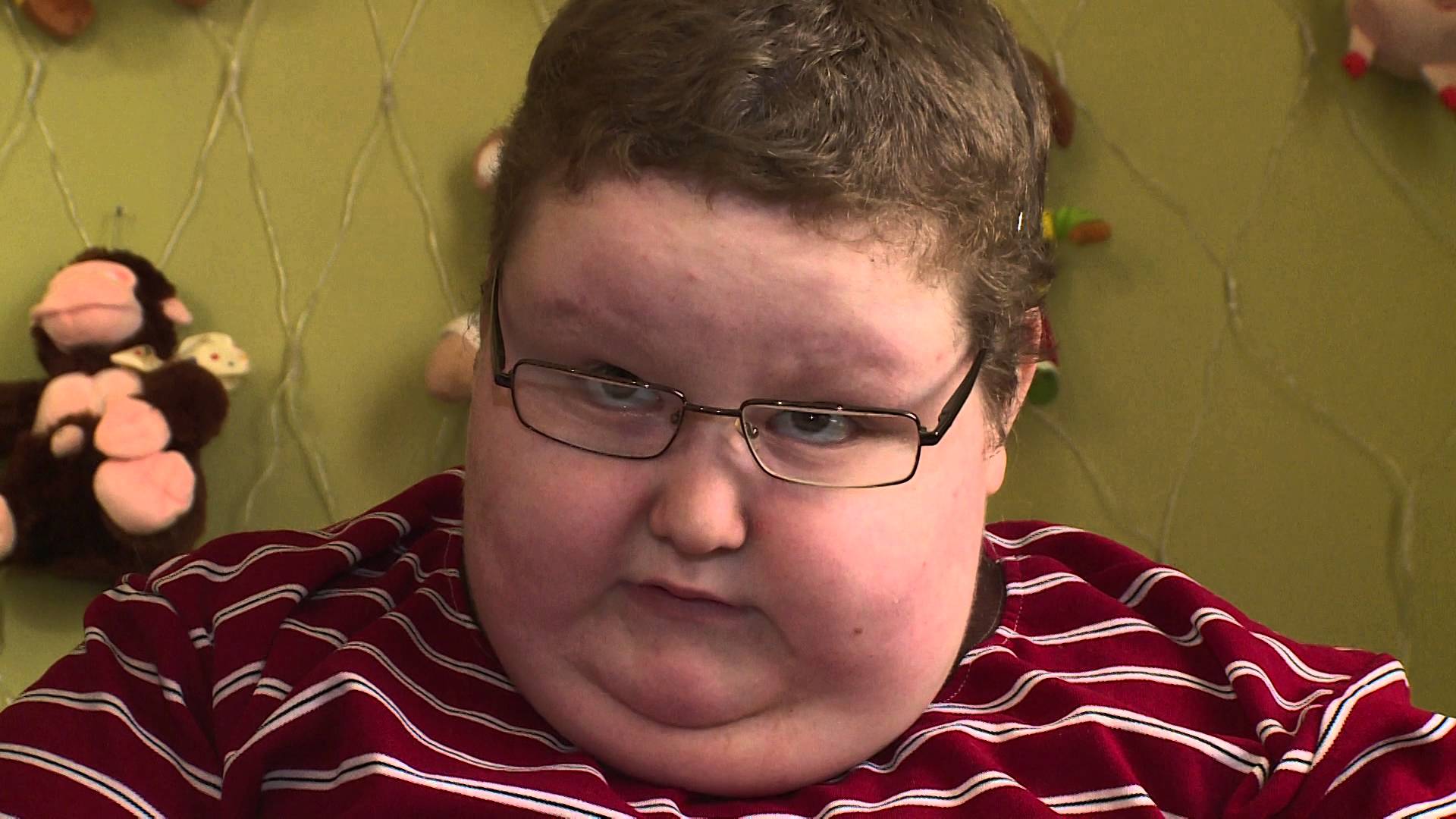 Мальчик с синдромом Прадера-Вилли