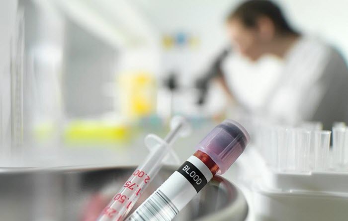 Анализ крови на гормоны