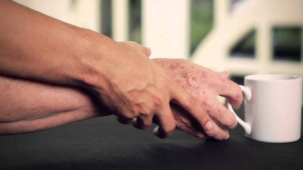 Судороги при эписиндроме