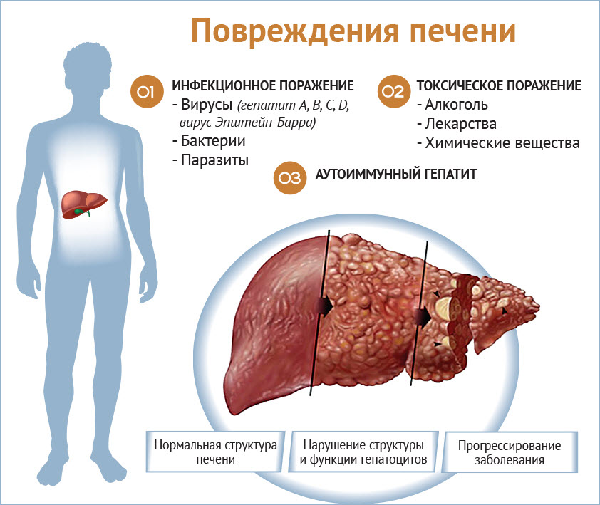 Причины повреждения печени