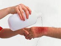 первая помощь при ожоге кипятком