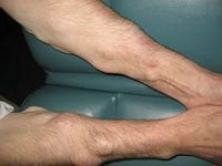 причины возникновения липомы