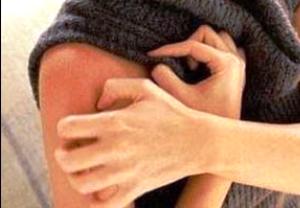 почесуха лечение фото