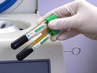 процедура плазмолифтинг лица