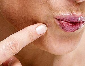 плоские бородавки на лице фото