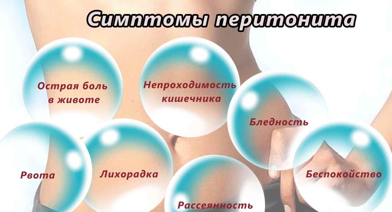 Симптомы перитонита