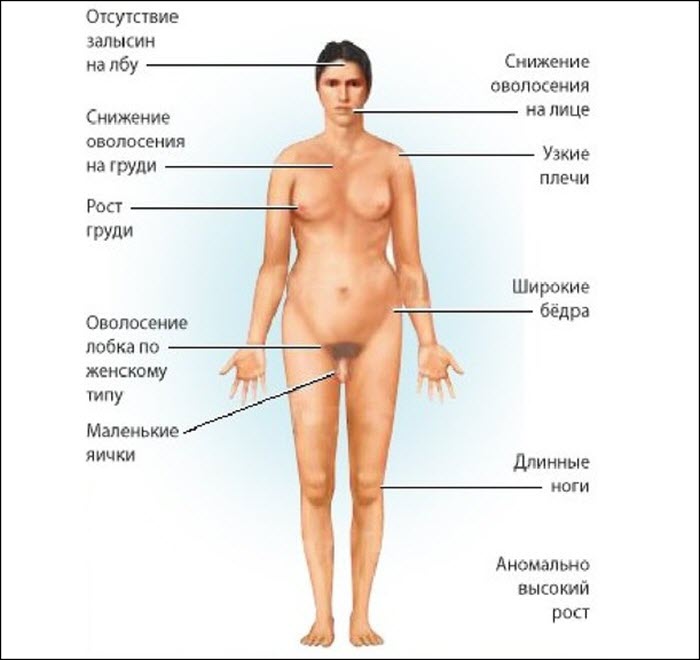 Признаки гипогонадизма у мужчин