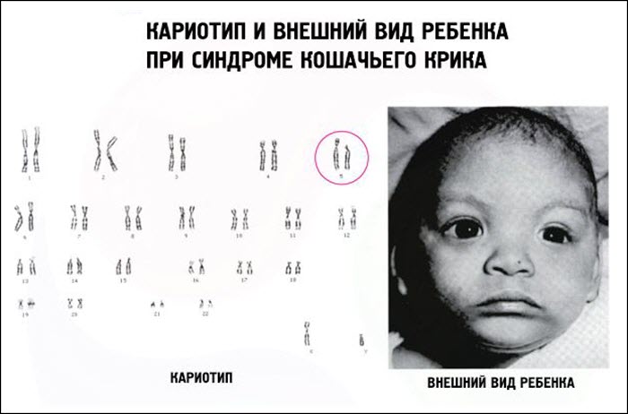 Генетическая мутация