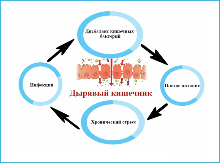Дырявый кишечник