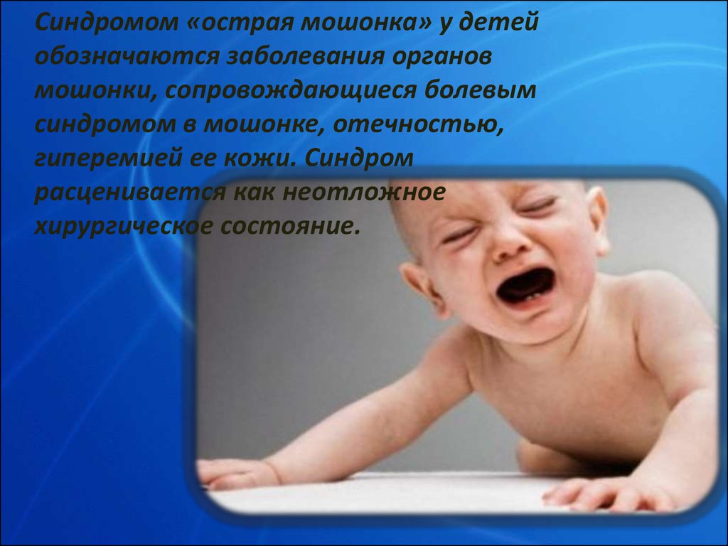 Синдром острой мошонки у детей