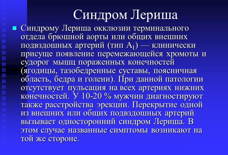 Синдром Лериша