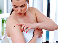 стоит ли удалять родинки