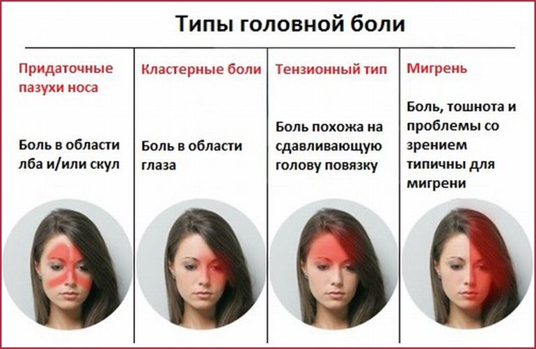 Типы головной боли