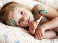 первые симптомы ветрянки у детей