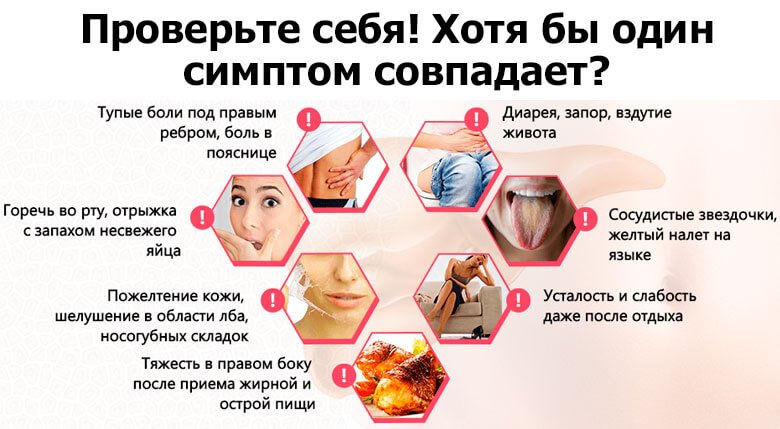 Симптомы поражения печени