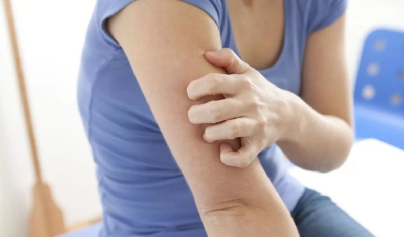 Зуд при заболевании печени